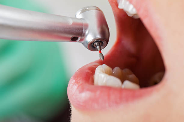 Best Emergency Dental Services for Seniors in Calabash, NC